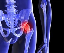 good-candidate-hip